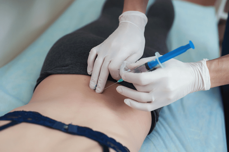 blokāde jostas daļas osteohondrozē